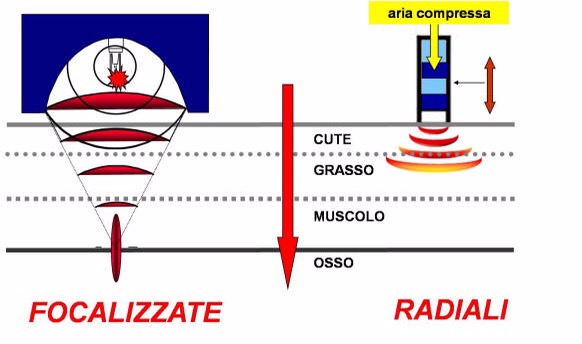 onde-d-urto-1